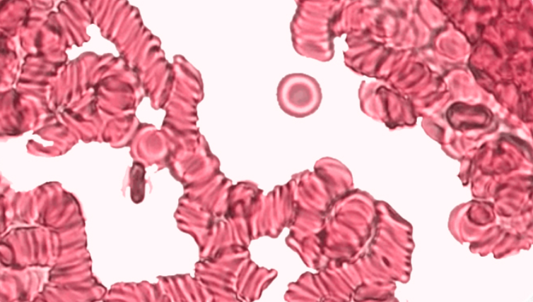 Baseline Blood Sample